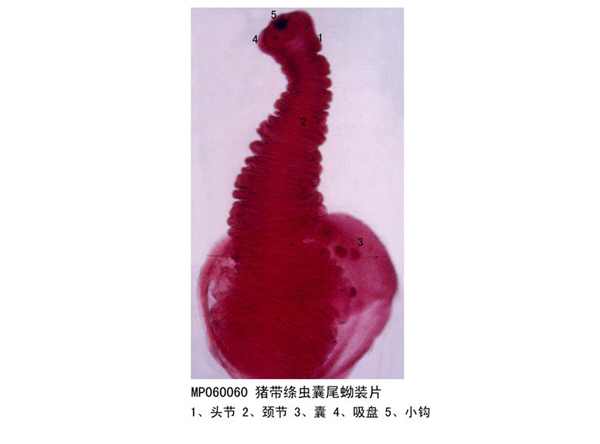 豬帶絳蟲囊尾蚴裝片