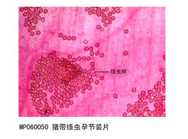 豬帶絳蟲孕節(jié)裝片