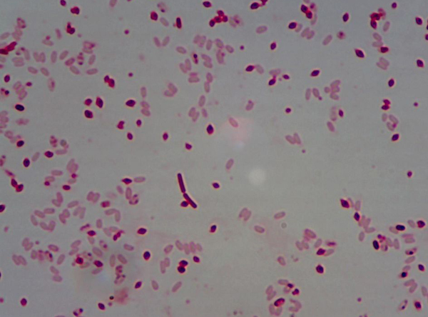 蘇云金芽孢桿菌