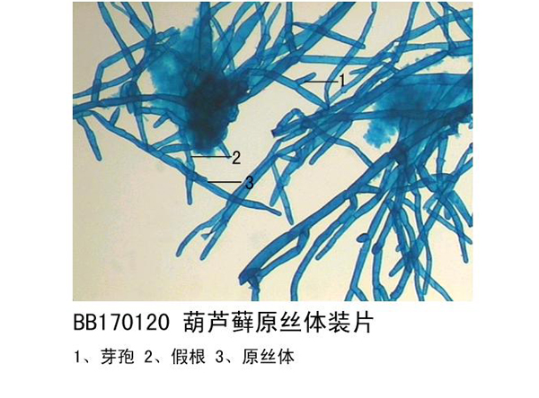 葫蘆蘚原絲體裝片