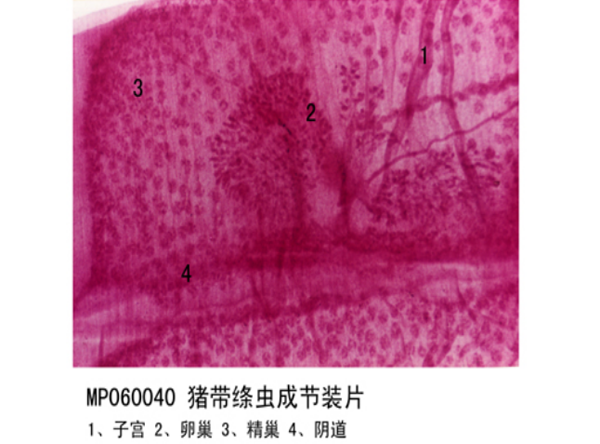 豬帶絳蟲成節(jié)裝片